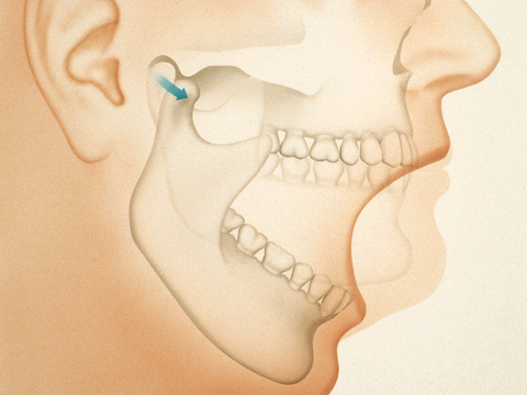 Jaw